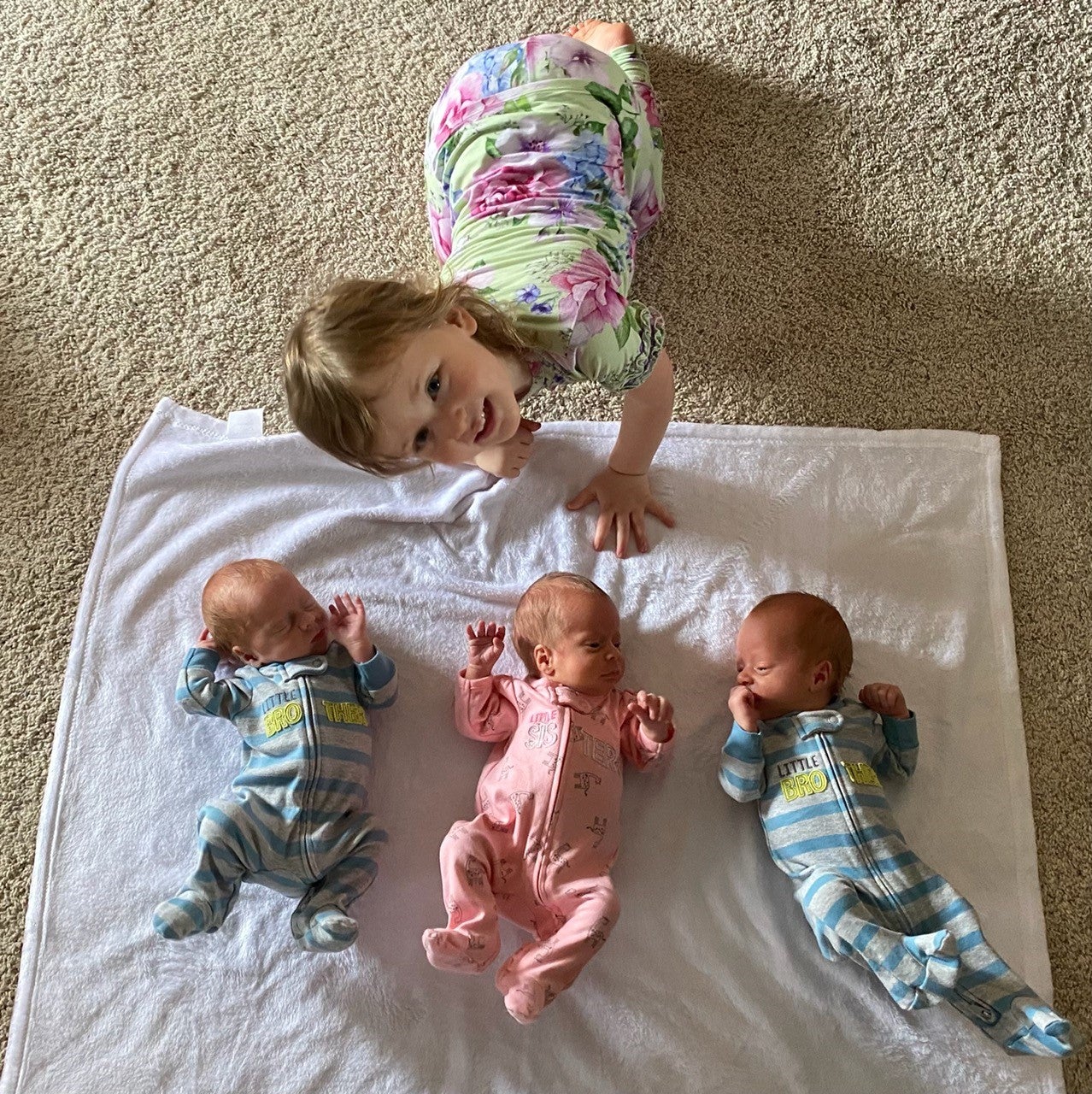 A triple blessing: Couple delivers set of natural triplets, two with twin-to-twin transfusion syndrome